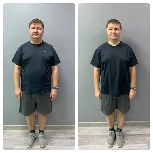 Before and After Daniel W